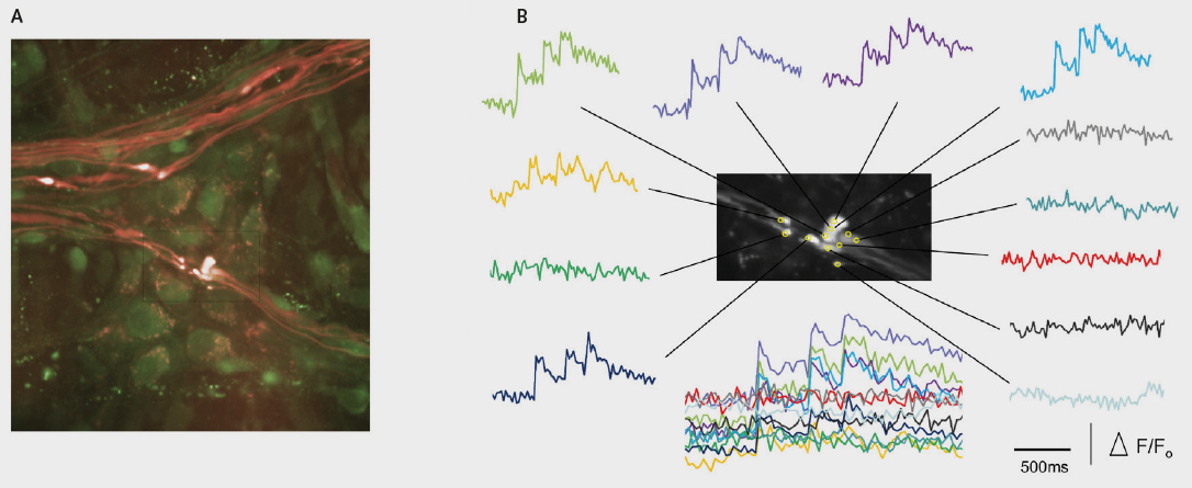 Electrophysiology and Calcium Imaging 配图 1