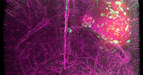 mesoSPIM Volume Imaging 配图 1