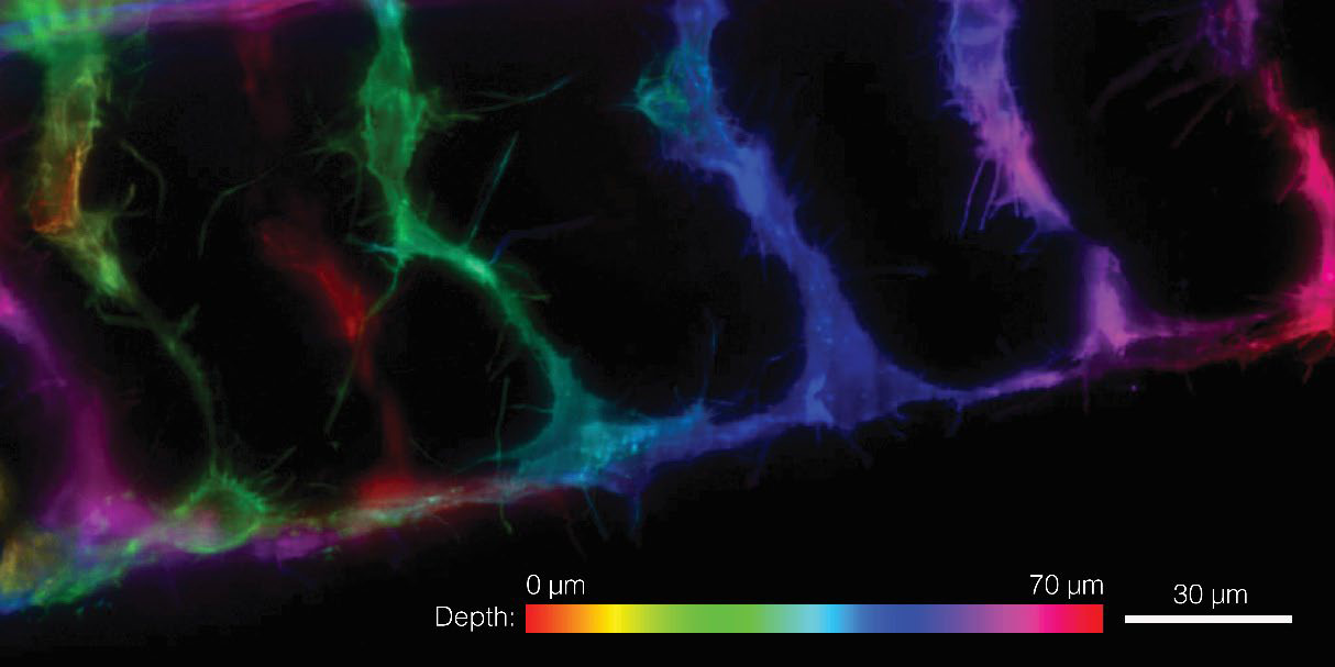 3D Axially Swept Light-Sheet Microscopy 配图 1