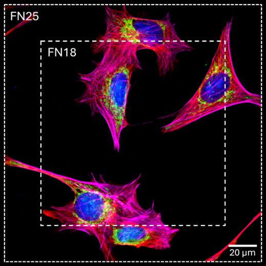 Comparing a FN18 system with the FN25 provided by the AION and Kinetix, using a 60x 1.42 NA objective. Image shows D. me